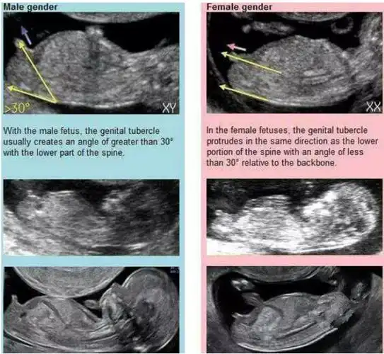 b超三条白线是女孩nt三个亮点是男孩女孩