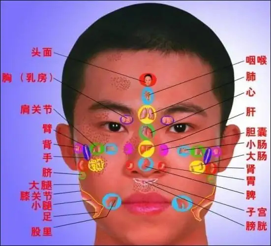 长斑的位置图解44