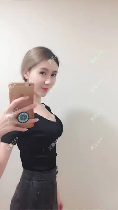 自体脂肪隆胸效果图_更美用户tbuhg754xg_术后88天__更美