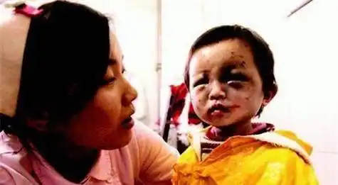 青海小苏丽:3岁被针线缝嘴,5岁被虐死,母亲出狱后将其挫骨扬灰_燕志云