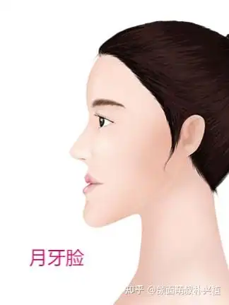 下巴和额头的凸出,呈现月牙弯的面相