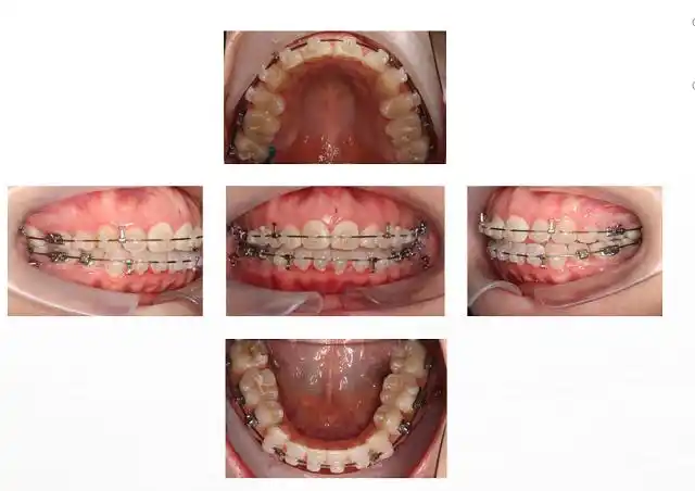暨大穗华口腔正畸才俊谢晓聪:精益求精的技术永远是每一位医生的追求