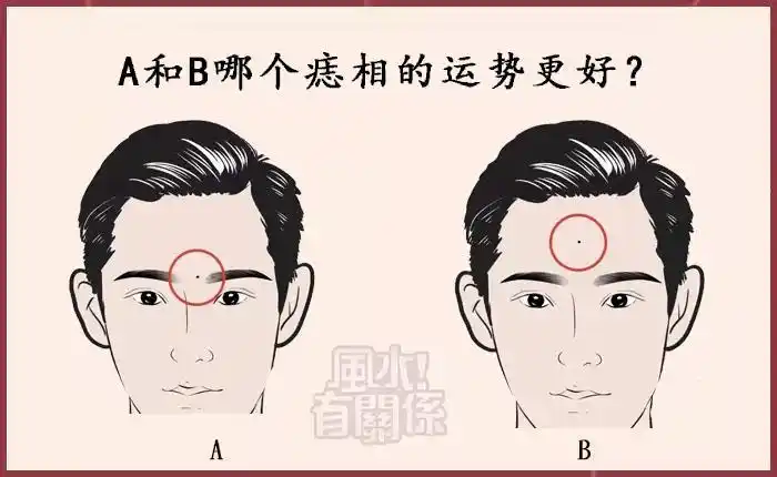 注意长这三种痣的男人,千万不能嫁!