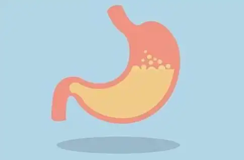 胃酸过多的症状