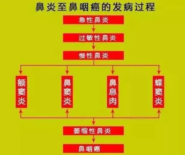 香港著名男星因"鼻癌"而死,但绝大部分人却不知道