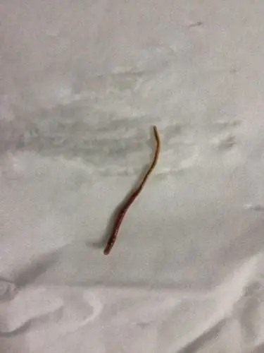 洗手间下水道爬出来的虫子,请问有害吗?