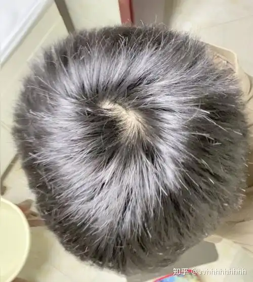 什么样子的发旋是正常的啊? - 知乎