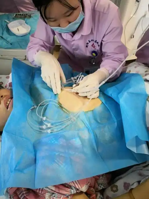 乳管灌注–小治疗,大作为