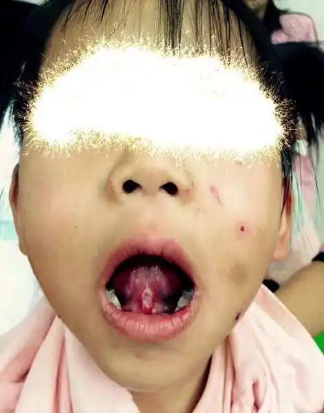 镇江一4岁女孩遭暴力伤害 浑身伤痕累累