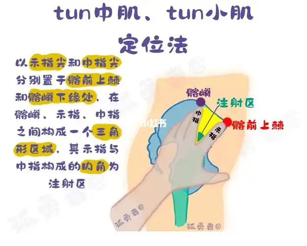 肌内注射  #每日一图  #医学插图  #护资考试  #护考