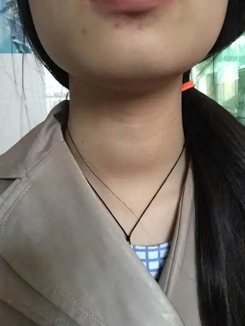 最近才发现脖子有点粗怎么才能看出这个是不是甲亢