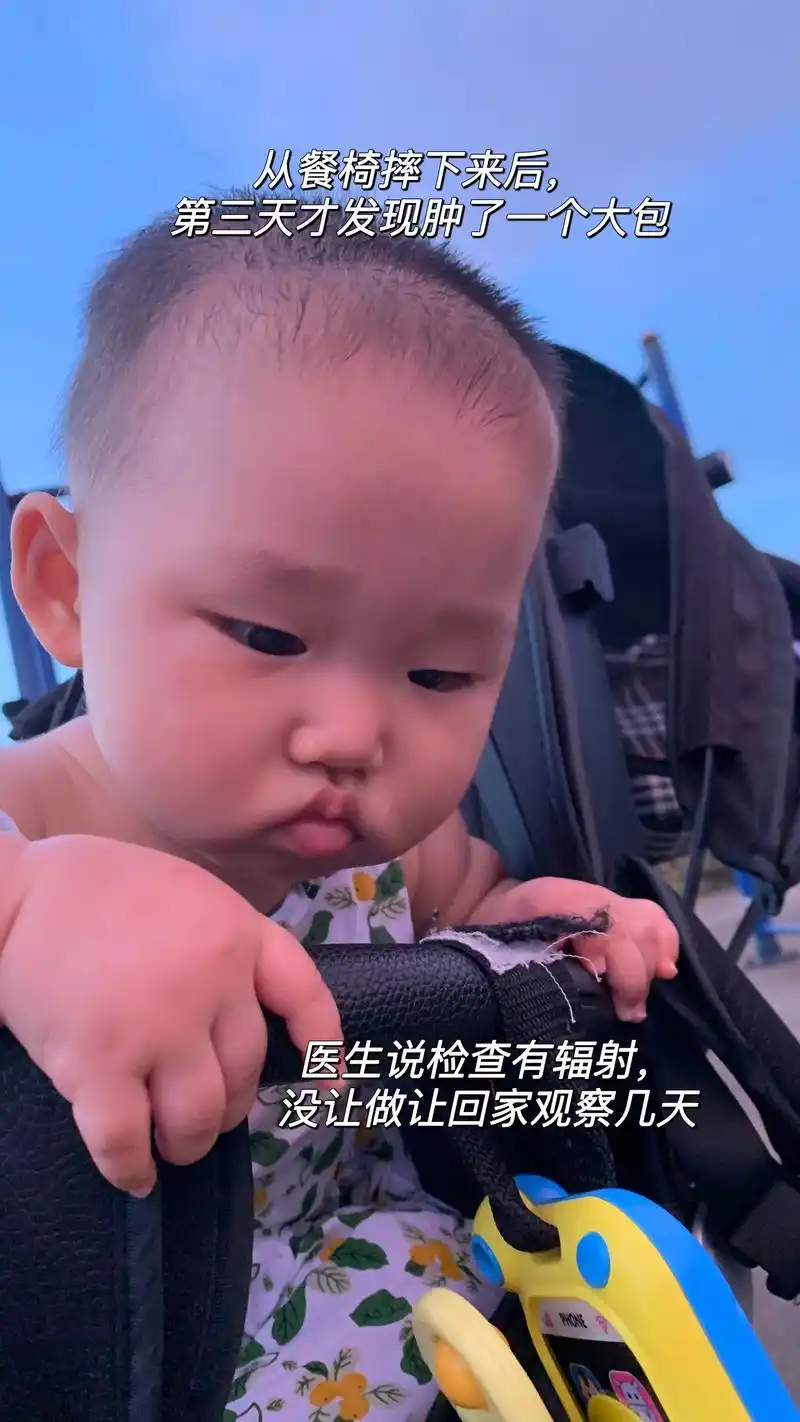 宝宝额头肿了个大包,怎么办.宝宝从餐椅上摔下来了,三天了突然 - 抖音