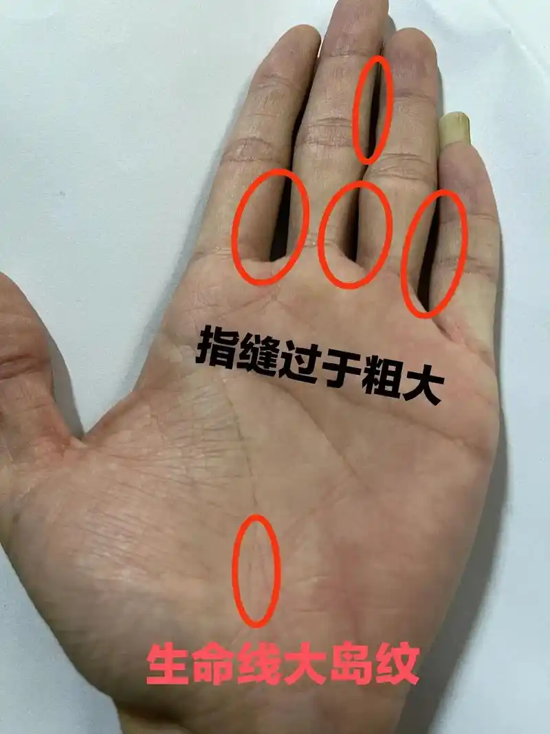 命理命运命格,慢性病,治不好类型.万般皆是命,半点不由人,红 - 抖音