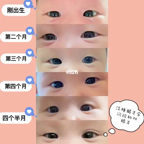 你们的宝宝几个月蜕变的双眼皮