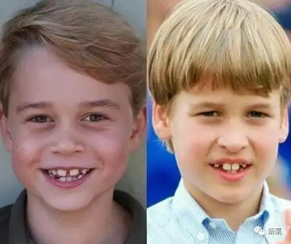 龅牙是皇室的标配?"突出"的贵气是这么来的?