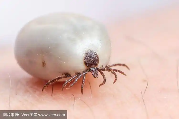 人皮肤上长满血的蜱虫
