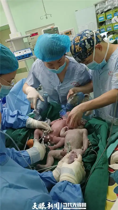 罕见子宫扭转90省医专家助42岁高龄孕妇产下双胞胎