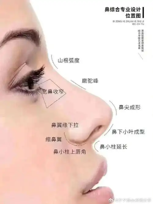 手术方式放入假体或者自体软骨2.注射隆鼻玻尿酸,维持时间3到12个月3