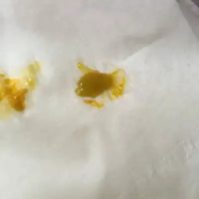 宝宝58天,纯母乳餵养,今天拉大便拉出这个像鼻涕一样的,这是什麼原因?