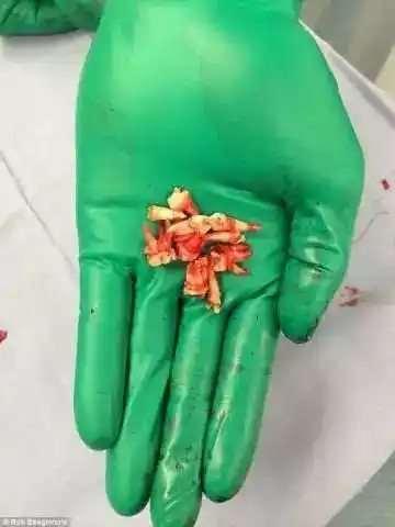 牙医不得不给人们看看这些恐怖的照片