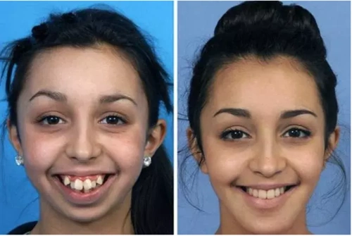 孩子就是磕了一下,怎么牙不齐了脸也歪了?