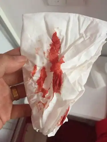 孕早期见红说明胚胎强 怀孕两个半月出血保胎保险得住吗?