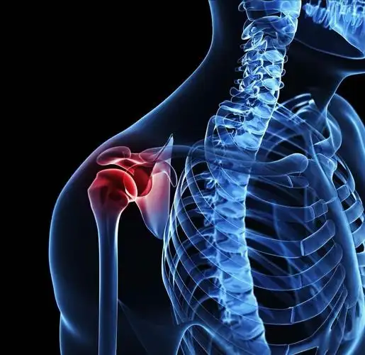 不是所有的肩痛都是肩周炎_肩周炎_疾病介绍_日常护理_介绍_日常注意