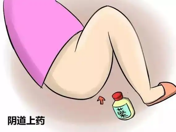 图片教学甲硝唑栓正确使用方法,跟着步骤走助你成功放入