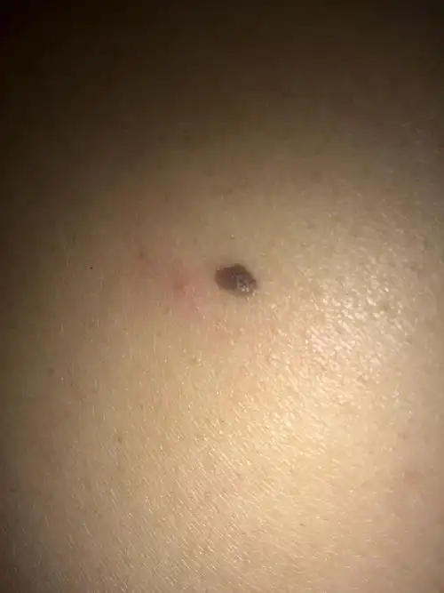 排序|按时间排序 1条回答  2015-10-20 23:06  热心网友最快回答 痣