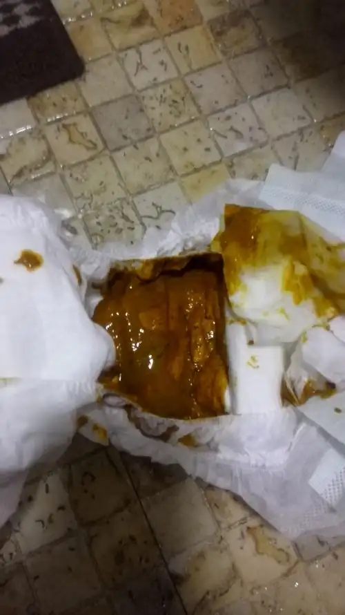 四个月3天的宝宝,纯母乳喂养,便便粘稠带有褐色丝状物,不知道是不是