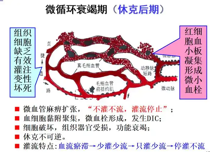 期(休克早期)(3)微循环变化③创伤所致的持续或强烈的刺激影响神经