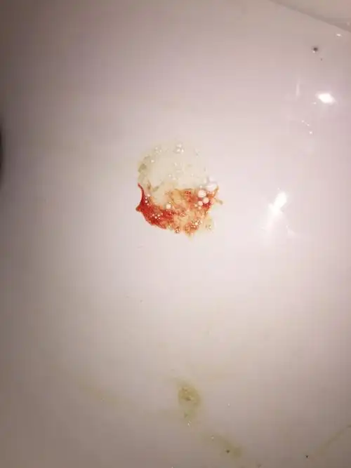 医生们好,咳嗽半个月了,之前熬夜熬通宵有点受风寒,就一直咳嗽,现在