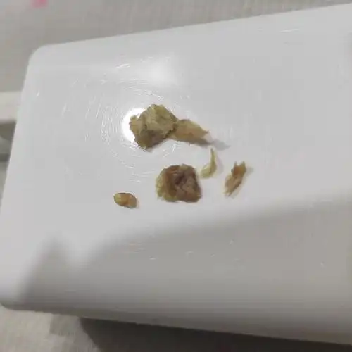 (有图慎入)自己掏的耳屎