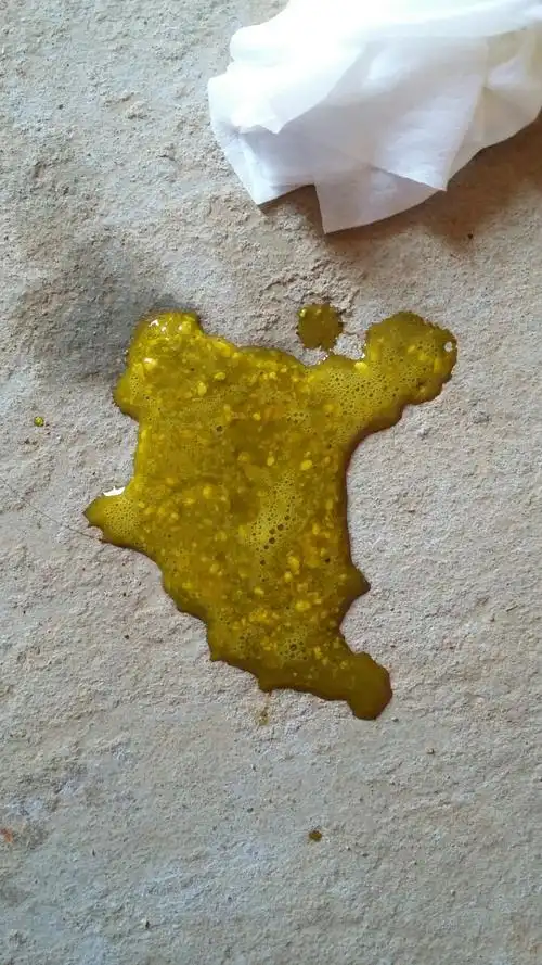 宝宝四个半月拉这样的便便正常吗?