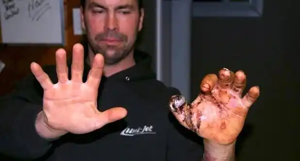 枪支炸膛到底有多可怕?