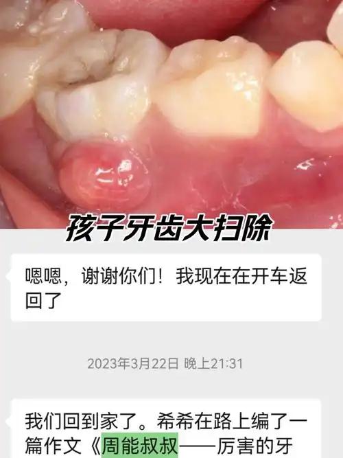 孩子牙龈长了一个包