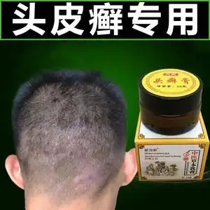 头癣药膏治疗毛囊炎皮肤瘙痒止痒抑菌头部真菌感染去头屑头藓神器