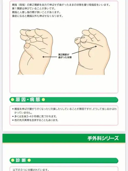 在日本宝宝拇指内扣矫正及扁平足改善锻炼法