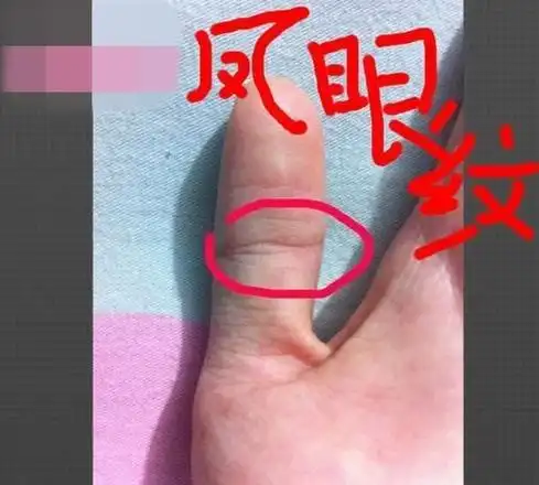 此缘主的手掌上,有两条婚姻线(二婚纹),长短不一,而且还不平衡,则说明