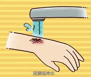 幼童不幸被烫伤,家里人的不当处理方式让医生感到叹息