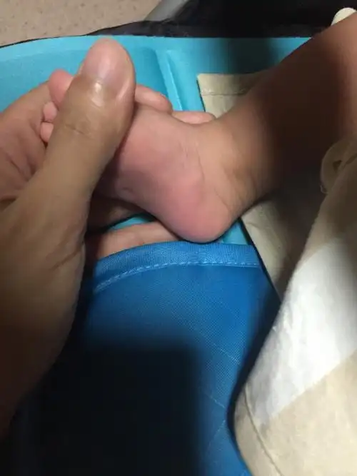 宝宝两脚内侧凸起一块