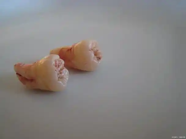 预防牙齿脱落,了解原因和方法