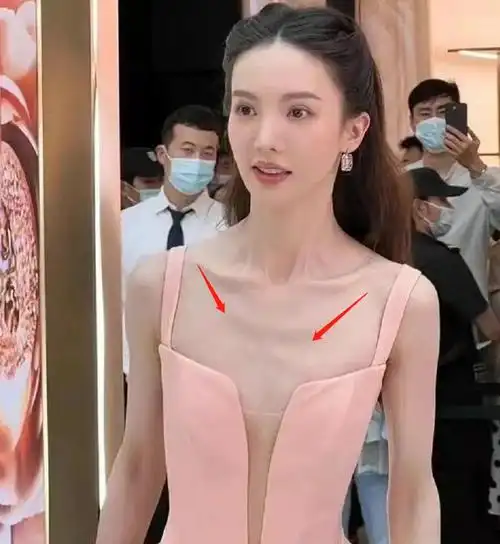 蝴蝶骨直角肩排骨胸现在女星的身材追求都是瘦成骷髅架