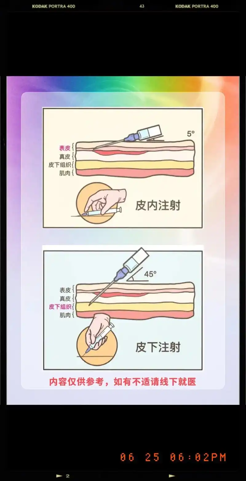 4种注射方法详解!#护士 #护士懂护士