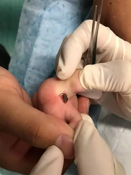 快. - 网友爆料 - 大诸暨 - powered by discuz!