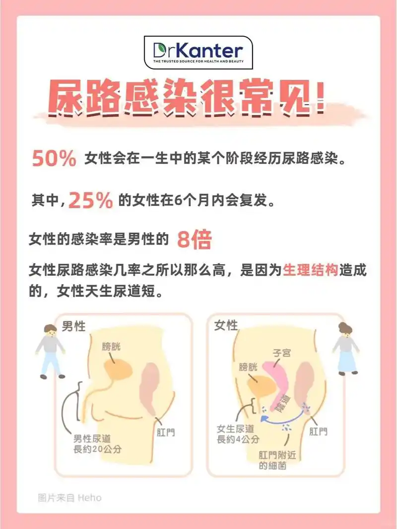 女性尿路感染知识7张图解答,快收藏!干货.#尿路感染 #女性 - 抖音