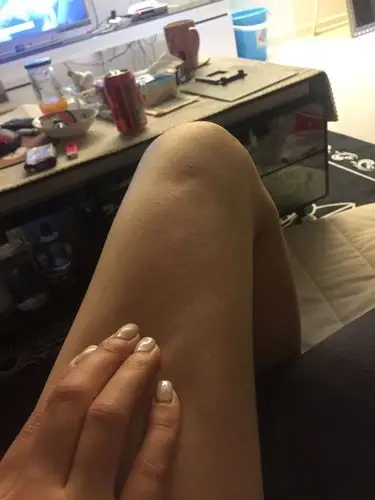 本人以前94斤 现在101斤 刚发现这个问题 是病还是胖了脂肪堆积