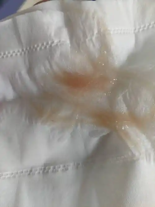 肺咳血怎么治疗(人一咳血就危险了)