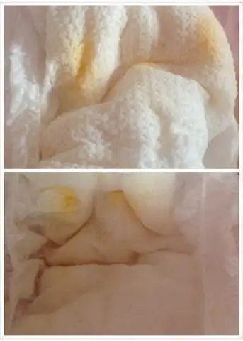 尿黄色正常么?有图慎入