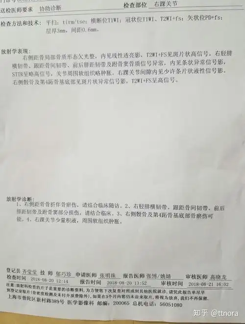 脚踝撕脱骨折两年了